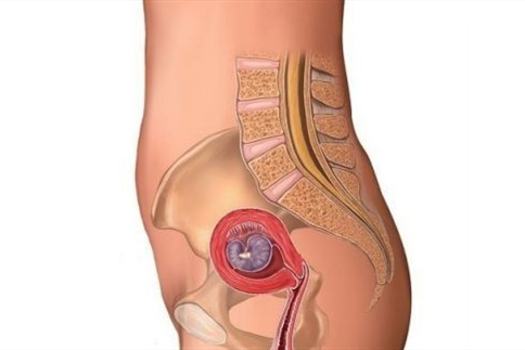 怀孕几天能测出来？