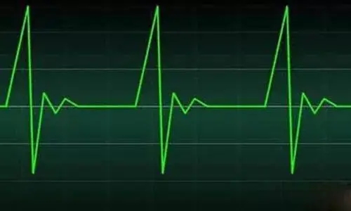 正常心率值范围是多少?