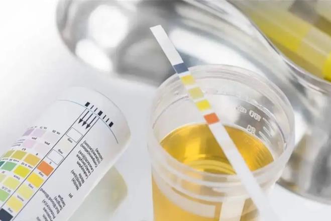 尿酸的正常范围值是多少？