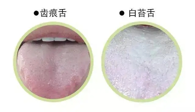 1662515378421600.jpg 舌苔又白又厚是什么原因引起的.webp.jpg