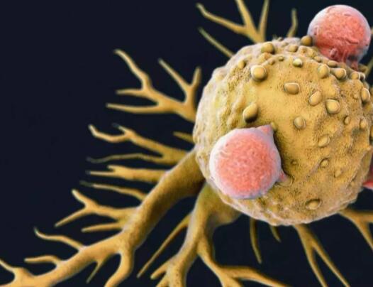 肿瘤患者“阳”了怎么办？