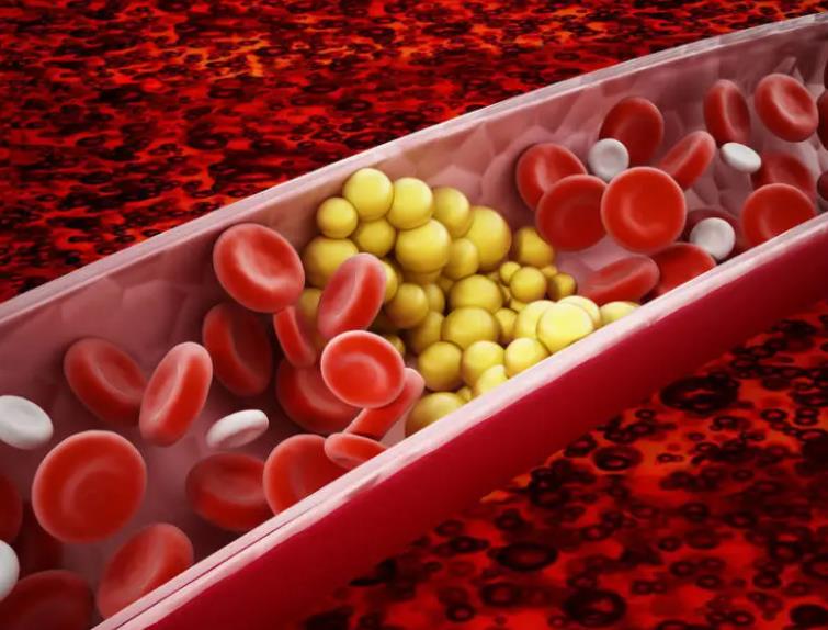 甘油三酯吃什么食物能降低血脂?