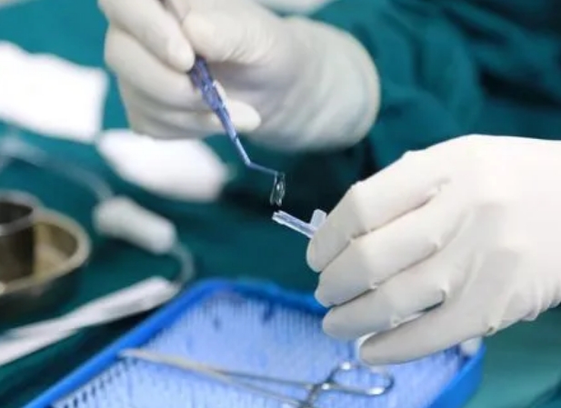 1698971617700782.jpg 近视手术有什么好处与坏处.jpg