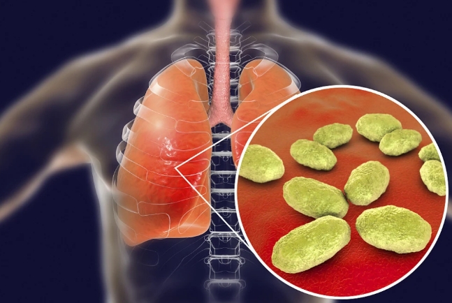 支原体肺炎是什么？