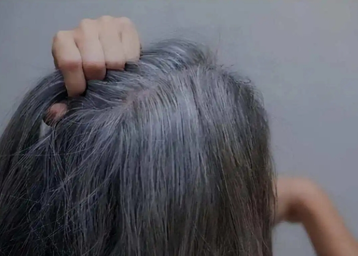 长白头发是身体发出报警信号吗？