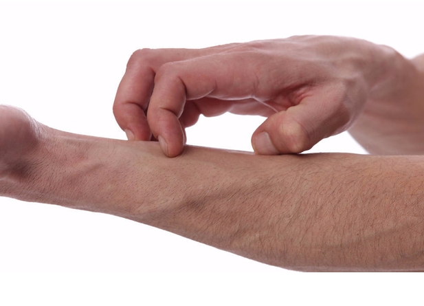 缓解湿疹瘙痒的方法有哪些？