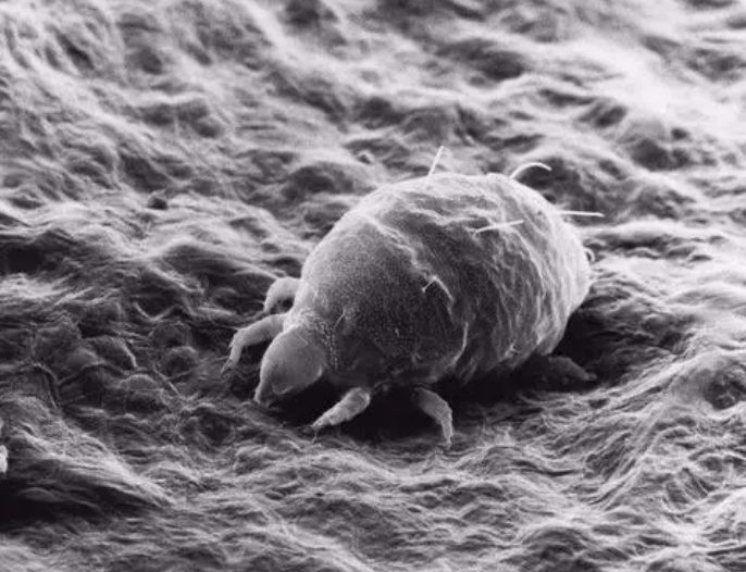 除螨效果很好的方法有哪些？